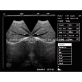 Ultra-sonografia de caderno de venda quente com sonda retal MSLPU24A